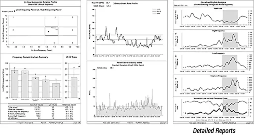 Hrv Reports